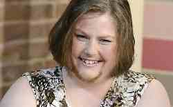 photo of PCOS sufferer Siobhain Fletcher who a frew facial hair for chartiy.
