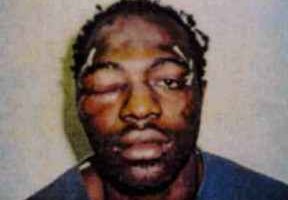 Rodney King dead at 47 photo after police beating