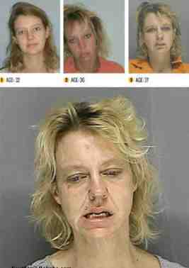 faces of meth updated showing the devasting effects of meth abuse
